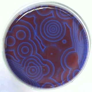 Belousov-Zhabotinsky reactions in a Petri dish.