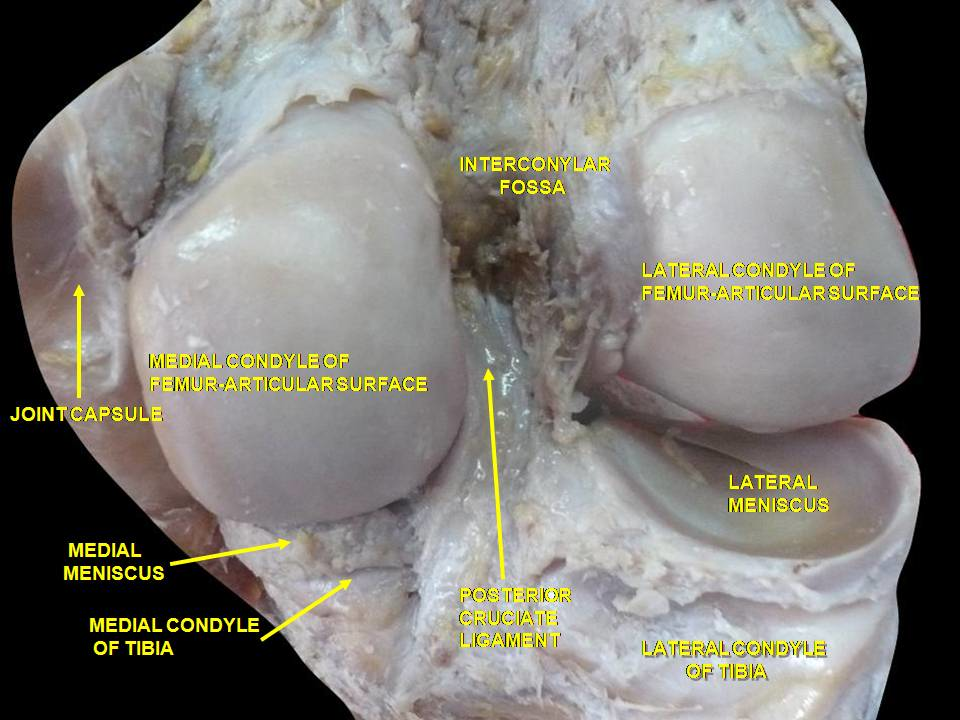Posterior Right Knee deep dissection.